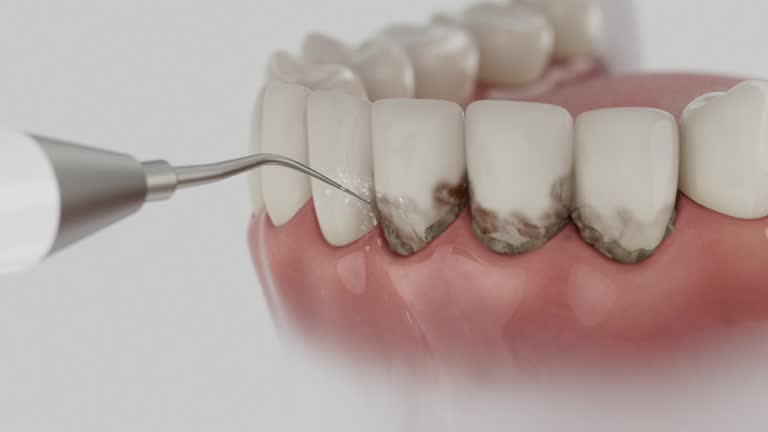 Reliable Tooth Extraction contractor in Hancock County County, GA by Dentist Open Now